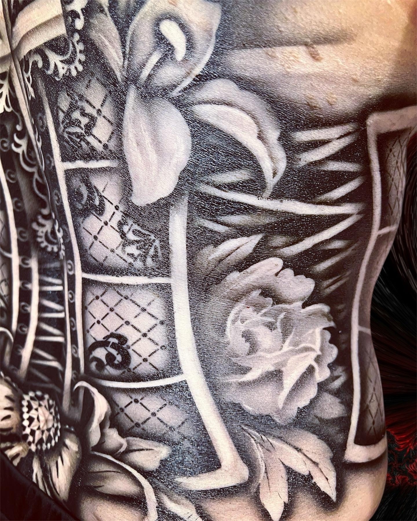 Corset Anterior (open)