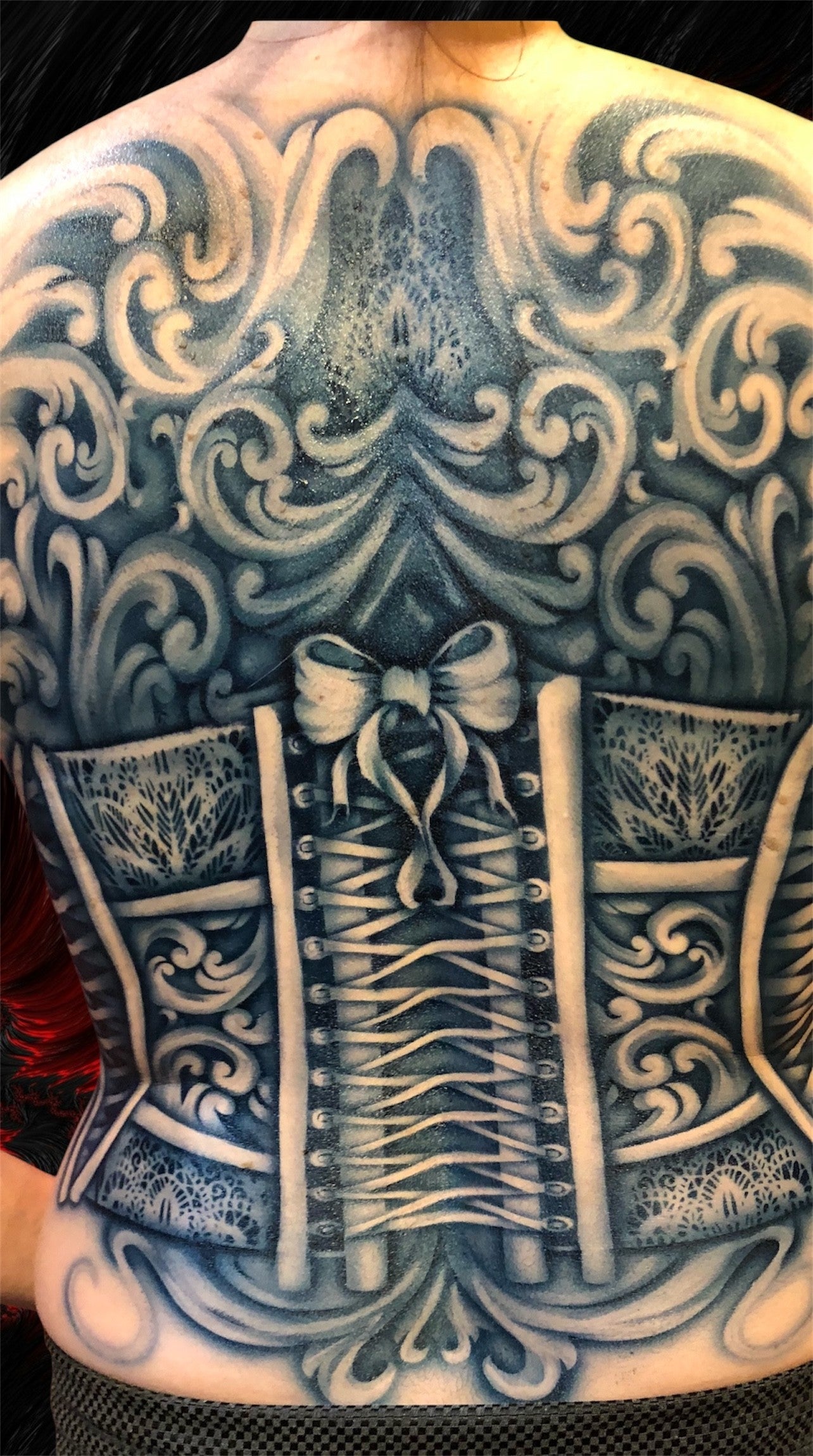 Corset Posterior (open)