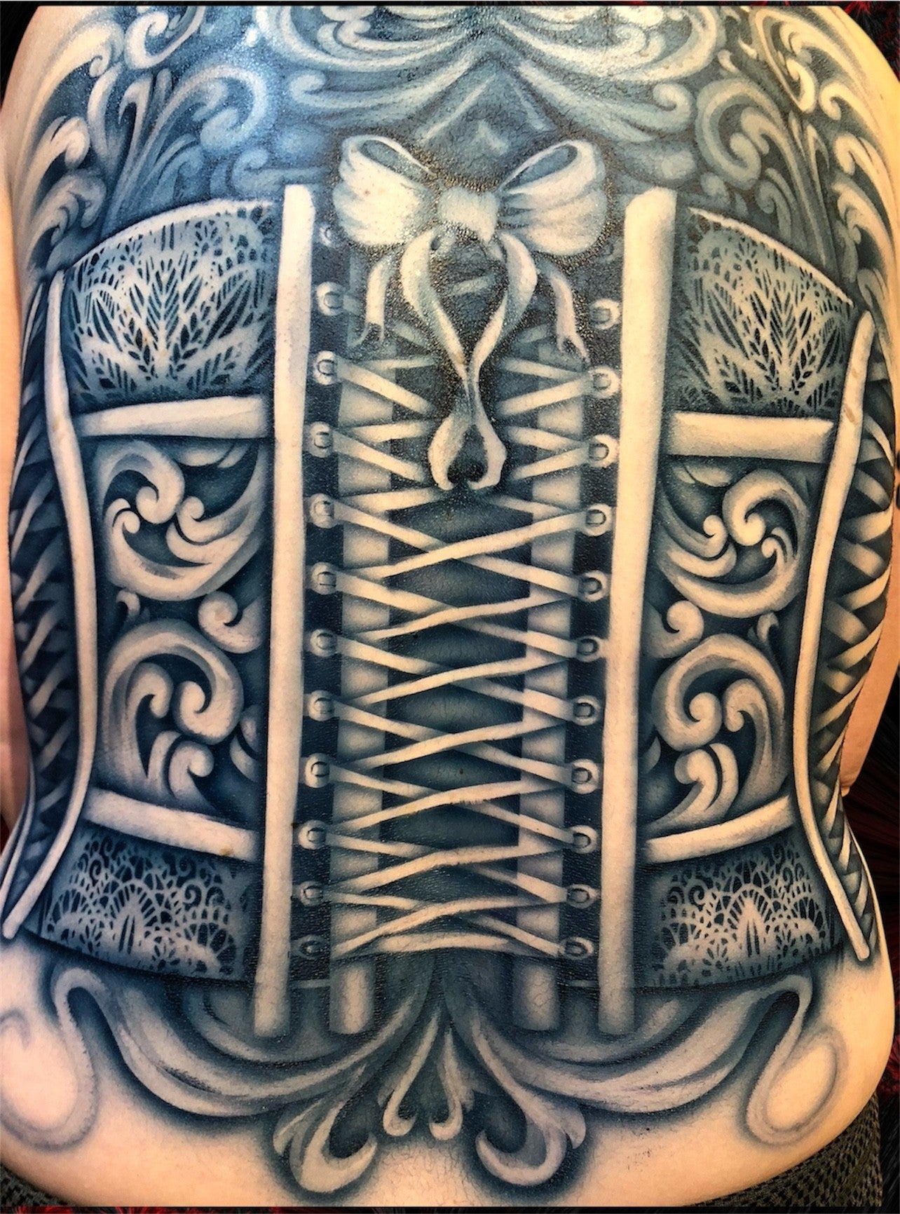 Corset Posterior (open)